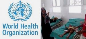 خطير : الصحة العالمية: وباء الكوليرا يهدد 10 مليون يمني بينهم 3 ملايين نازح